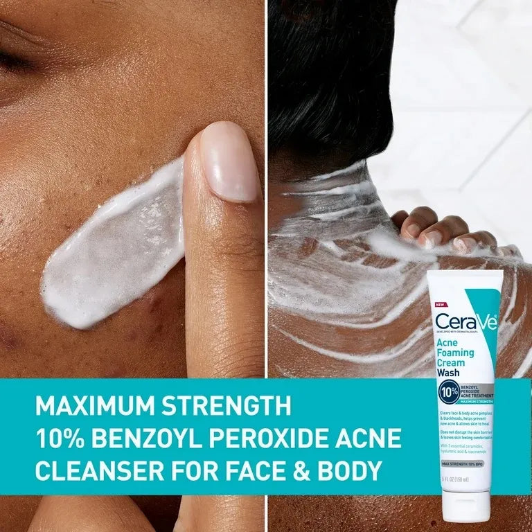 Tratamiento con Peróxido de Benzoilo al 10% para Acne 142 gr Cerave